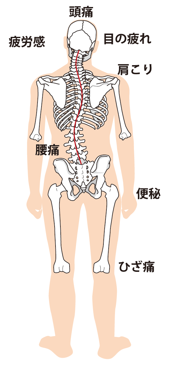 巻き爪専用の器具は国家資格者しか扱えないものです。