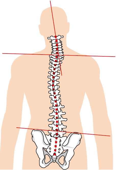 腰痛には特殊な器具を使用します。